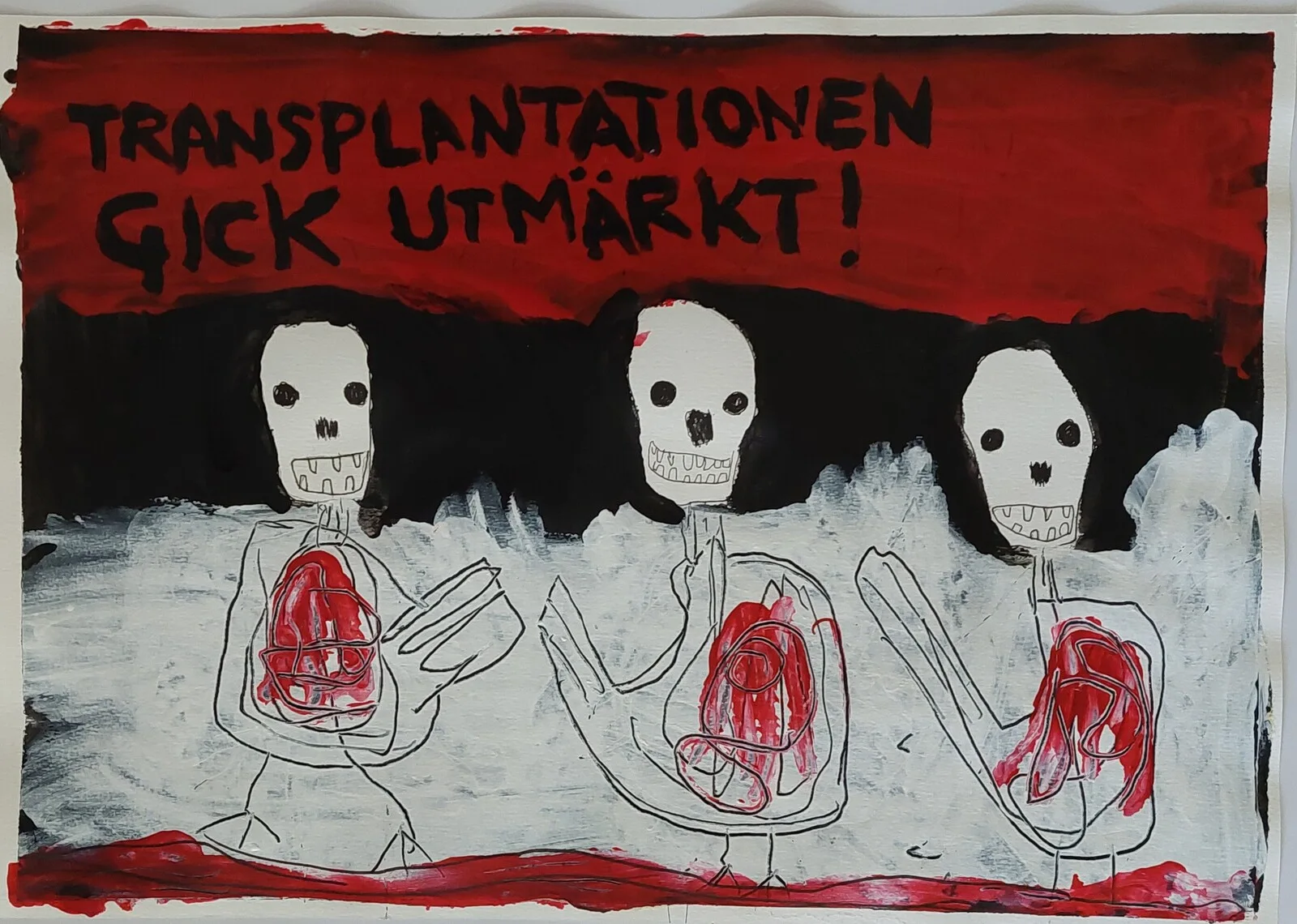 Akrylmålning Transplantationen gick utmärkt! av Mikael Jonsson