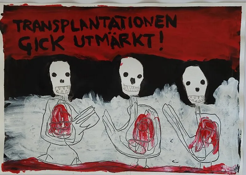 Akrylmålning Transplantationen gick utmärkt! av Mikael Jonsson