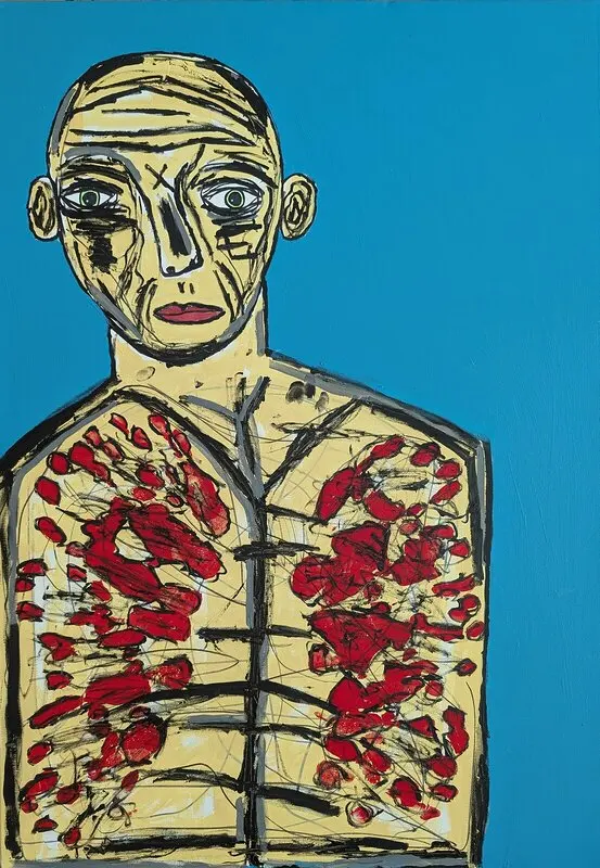 Lungs. (Non were sick, and non was well). av Mikael Jonsson