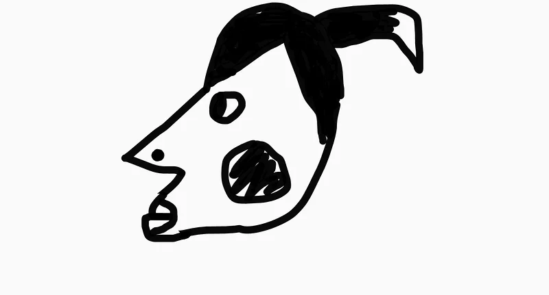 Hyperpigmwntation av Ikhlas Jimaale